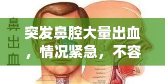 突发鼻腔大量出血,情况紧急,不容忽视!