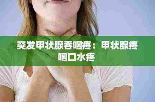 笨鸟先飞 第3页