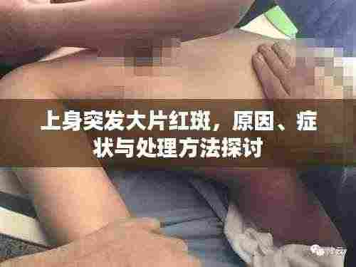 上身突发大片红斑,原因、症状与处理方法探讨