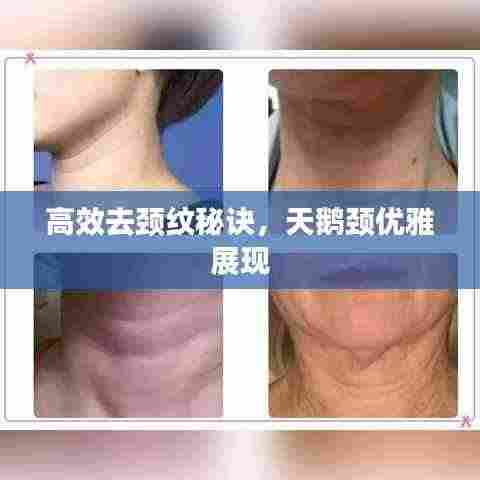 高效去颈纹秘诀,天鹅颈优雅展现